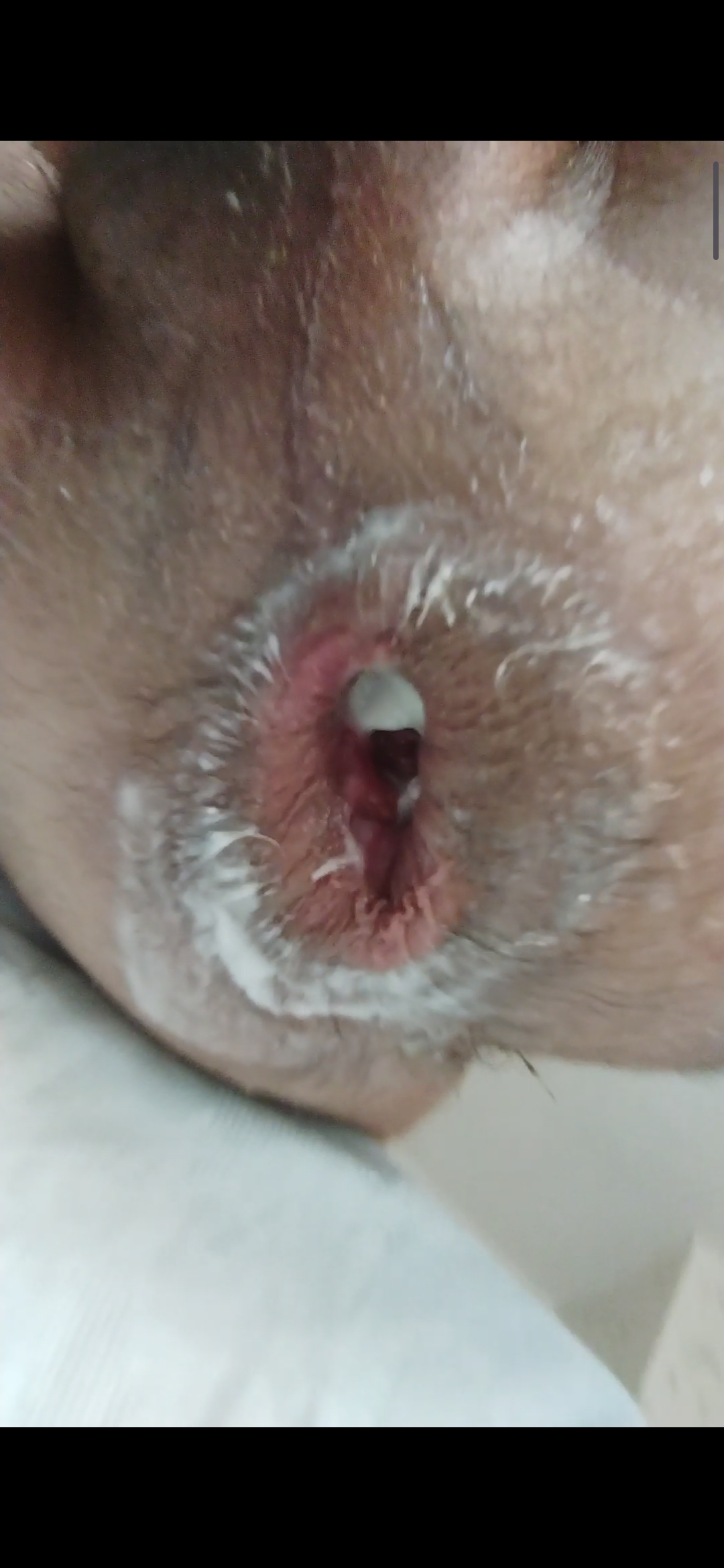 Hard ANaL — 14