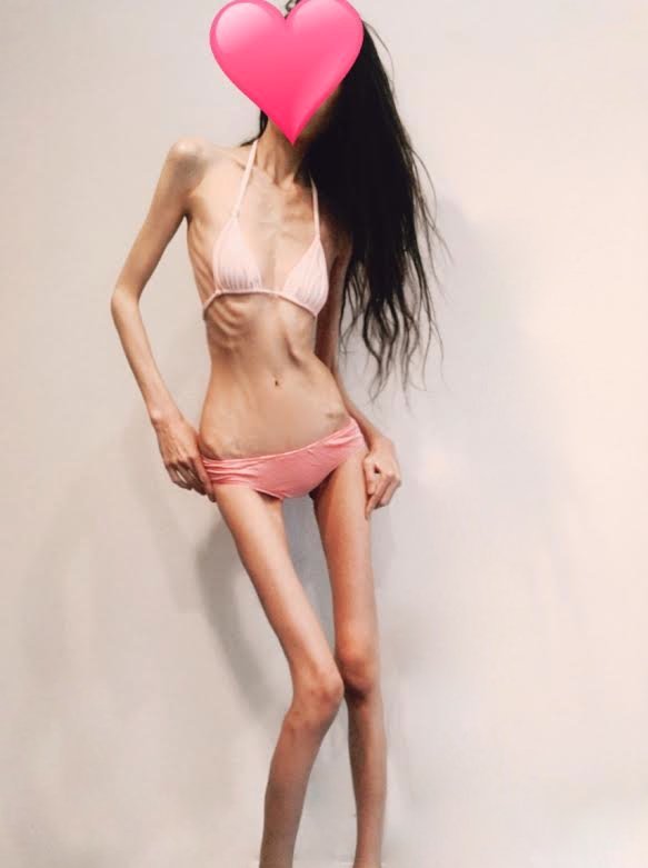 Bony Bitches:  You're Still Too Fat, Cunt! — 15